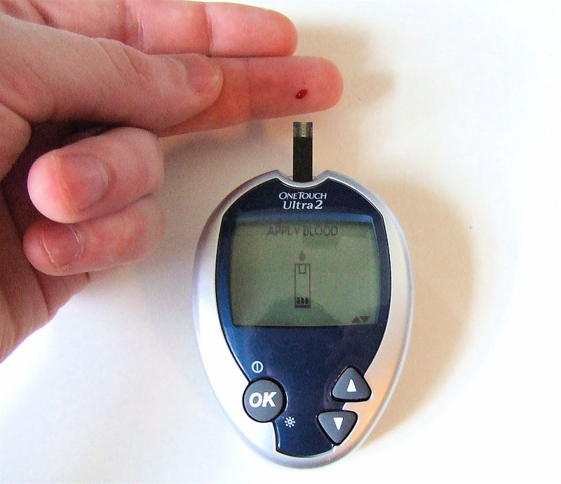 Información General Neuropatía Diabética Dolorosa